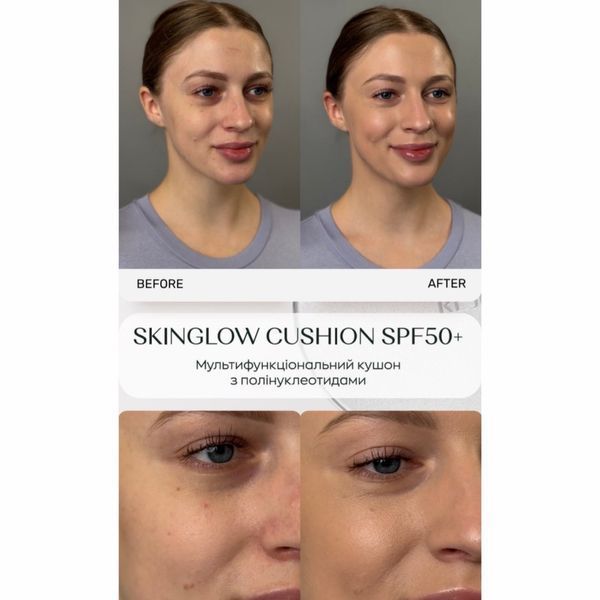 МУЛЬТИФУНКЦІОНАЛЬНИЙ КУШОН З ПОЛІОНУКЛЕОТИДАМИ REJURAN SKINGLOW CUSHION SPF50+  RJ019 фото